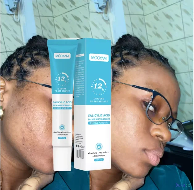 Gel Anti-Acné MOOYAM Acide Salicylique Salvia Miltiorrhiza, Élimination de l'Acné, Dissolution des Impuretés, Désincrustation Profonde des Pores, Nettoyage en Profondeur, 20g