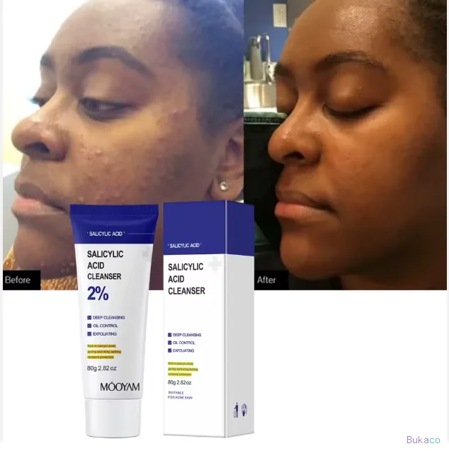 Nettoyant Visage à l'Acide Salicylique Anti-Acné Contrôle du Sébum Éclaircissant Exfoliant Nettoyage Profond Soin de la Peau MOOYAM